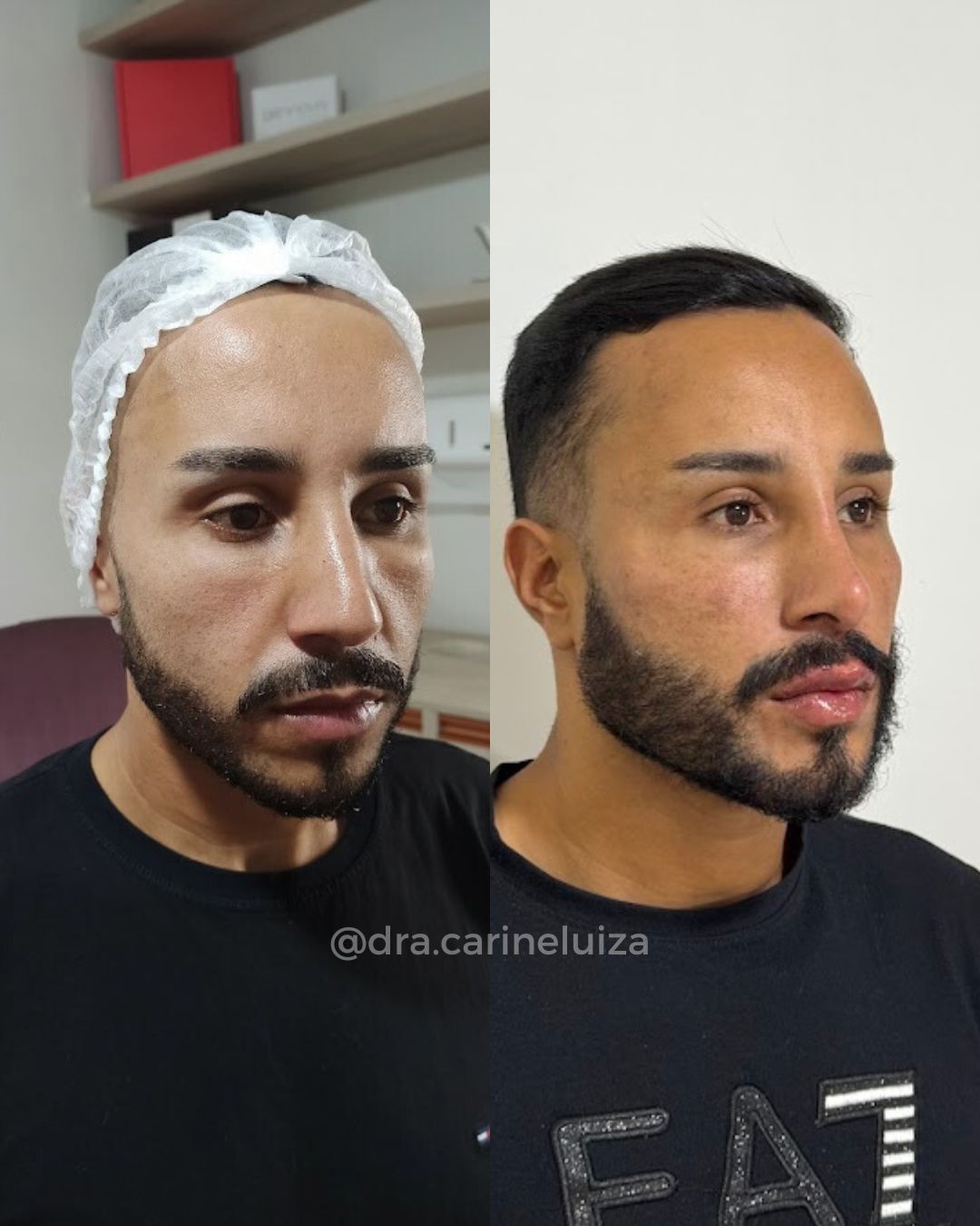LÁBIOS (2)