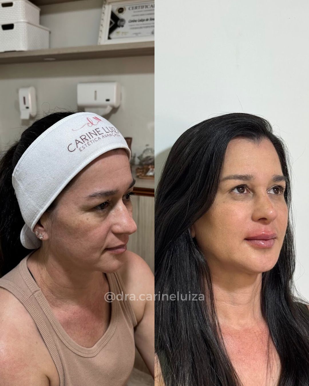 LÁBIOS